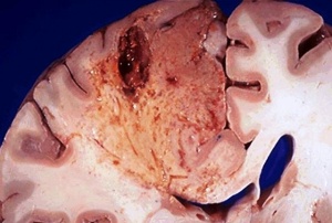 �������� �����, ������� ������ � ����